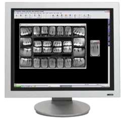 Digital x-ray sensor and viewer