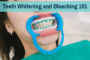 Teeth Whitening and Bleaching 101